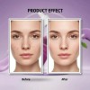 Serum Facial Antimanchas Reduce Las Manchas-niacinamida 20 Todo Tipo De