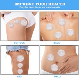 Excitsayno Silicone Cupping Therapy Set - Cupping Kit for Massage Therapy - Cellulite Remover Cupping Set - Anti Cellulite Cup Massager, Vacuum Suction Massage Cups for Cellulite Reduction