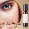 2PCS Eye Roller,Oil and Frankincense Eye Roller, For Eyes, Bags