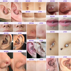 Piercing Bump Solution Oli & Keloid Bump Removal Gel