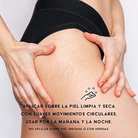 Crema Corporal para Estrías, Hidratante, 250ml