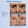 Sérum Contorno De Ojos Plexaderm Rapid Reduction: Reduce Vis