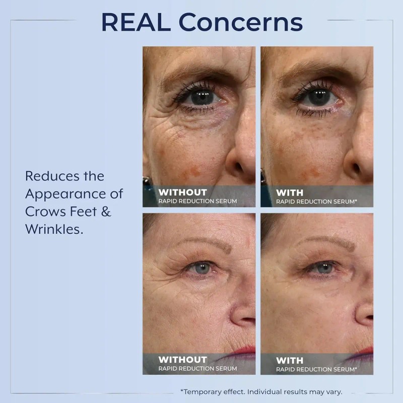 Sérum Contorno De Ojos Plexaderm Rapid Reduction: Reduce Vis