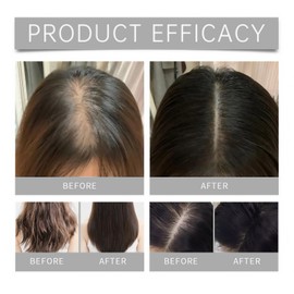 Deoxyribose Sugar Gel Hair Growth,Hair Thickening Essence,Hair Serum for Hair Growth,Hair Oil for Dry Damaged Hair,Hair Breakage Treatment,Deeply Nourish and Repair,Scalp Care and Moisturizing