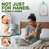 Crema reparadora de manos Miracle con 60% UltraAloe, 8 Oz