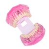 Transparent Adult Teeth Model Pathological Repair Studying Dental Teaching Tools