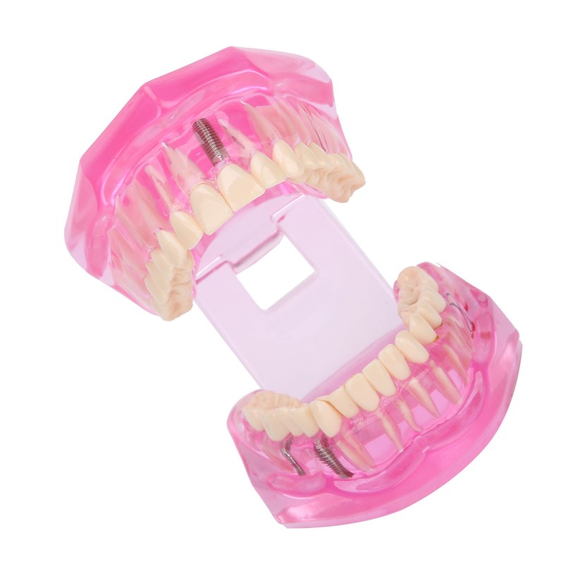Transparent Adult Teeth Model Pathological Repair Studying Dental Teaching Tools