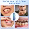 SarMee 4pcs Mullein Gum Repair Gel, Teeth Whitening Pen for