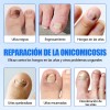 Parches Para Uñas Fúngicos 63pzs Caja De Parches Dañadas