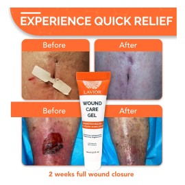 Gel De Cuidado De Heridas Avanzado De Lavior: Curación Más R