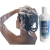 Skin Moisturizer 4 Piezas Psoriasis Facial Time