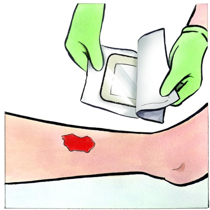 Medline Stratasorb Waterproof Adhesive Island Wound Dressings, 4 x 4