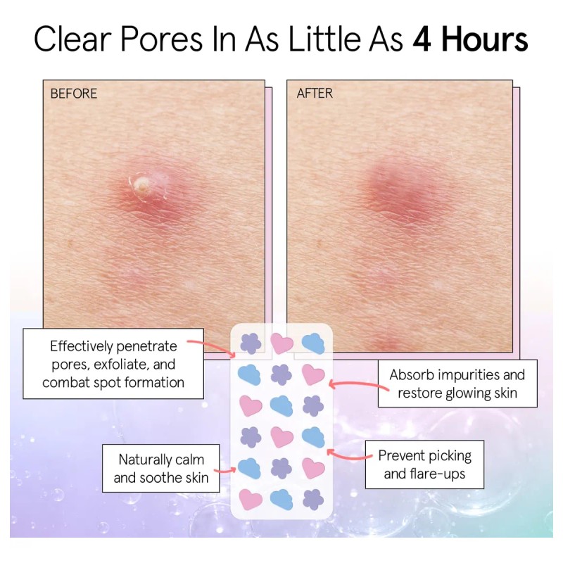 Grace & Stella Parches De Espinillas Para La Cara, Bonitos