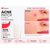 Umeva Acne Patch Hydrocolloid Pimple Patches (72 Count)
