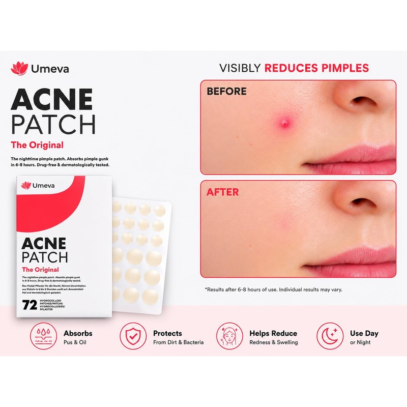 Umeva Acne Patch Hydrocolloid Pimple Patches (72 Count)