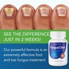 Enriched Vitamins (3 Bottle) Fungus Clear Premuim Probiotic Improves Toe