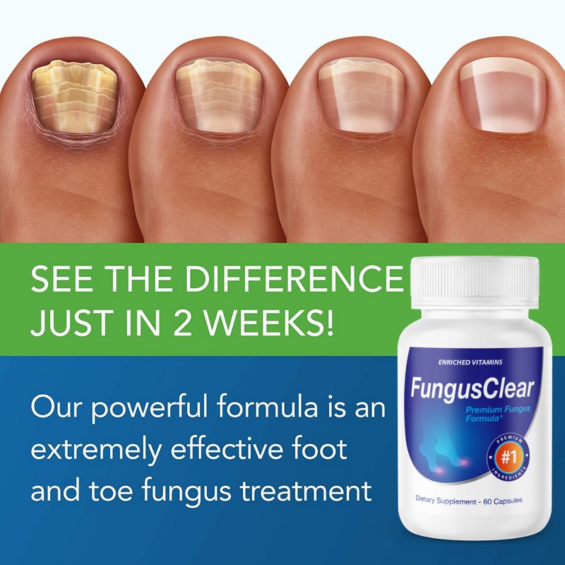 Enriched Vitamins (3 Bottle) Fungus Clear Premuim Probiotic Improves Toe