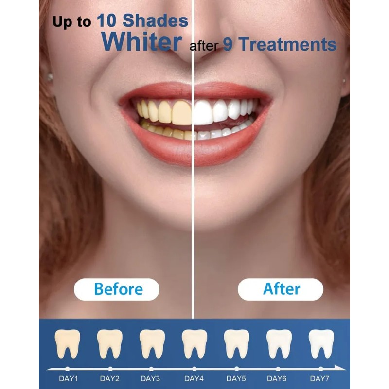 Mysmile. Repuesto Bolígrafo Gel Blanqueador De Dientes 3pack