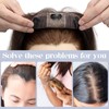 S-noilite Human Hair Toppers for Thinning Hair Women Real Hair