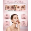 Red Light Therapy for Eyes, Wireless Under-Eye Red Light Therapy
