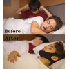 2PCS Chin Strap for Sleeping, Skin-Friendly Airflow Jaw Strap, Premium