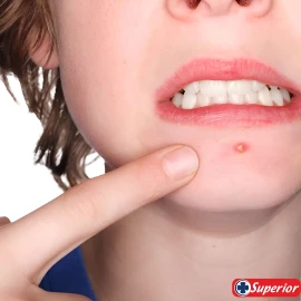 Crema Para Hongos 125g