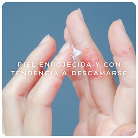 DERMAN Cuidados Intensivos PS Calm, Crema Corporal Dermatológica 300 g para Piel Deshidratada, Agrietada, con Descamación o para Piel de Personas con Psoriasis, con Urea-D 10%, Avena Coloidal y Ácido Salicílico, Hidratación Hasta 48 h