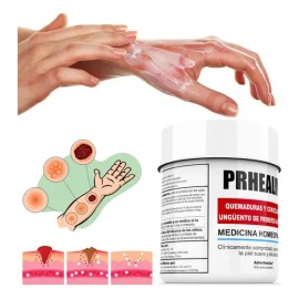 Crema Para Quemaduras Para Quemaduras En La Piel