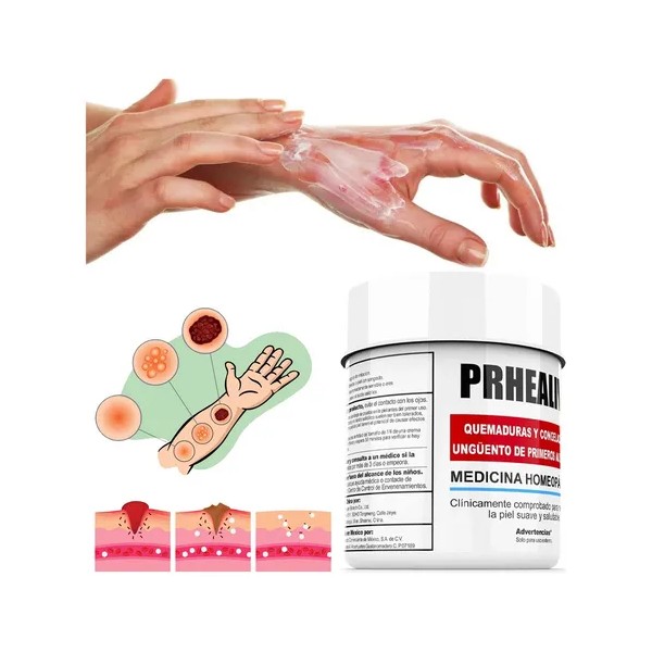 Crema Para Quemaduras Para Quemaduras En La Piel