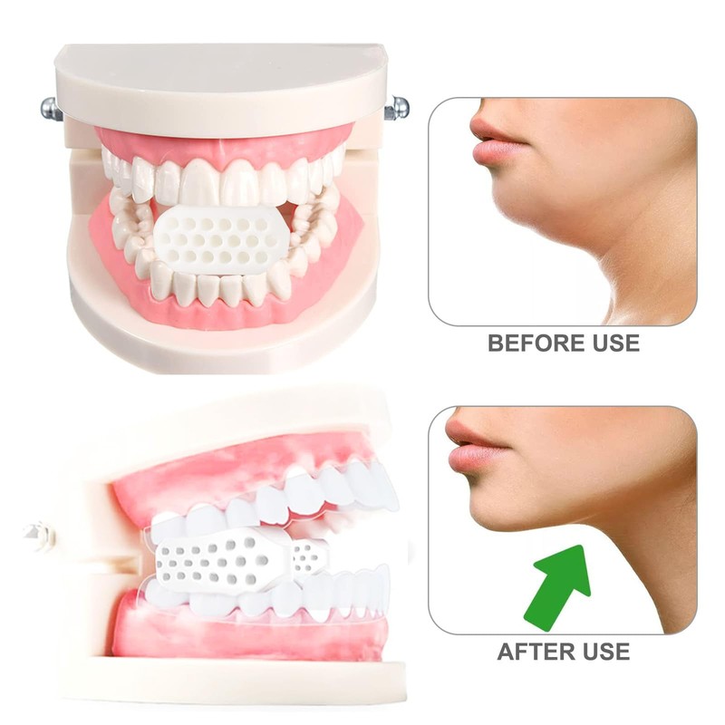 Jaw Exerciser for Man and Woman 3 Resistance Levels (6