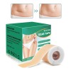 Lámina De Silicona Para Eliminar Cicatrices, Parches De Gel,