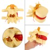 1:1.5 Anatomical Medical Human Spine Lumbar Disc Herniation Demonstration Model