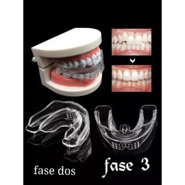 Trainer 3 Fases Dentales Bruxismo Tratamiento Completo