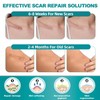 Extra Long Silicone Scar Sheets (1.6” x 200” Roll-5M), Silicone
