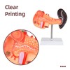 Simedutech Pancreas Spleen Anatomy Model, Normal