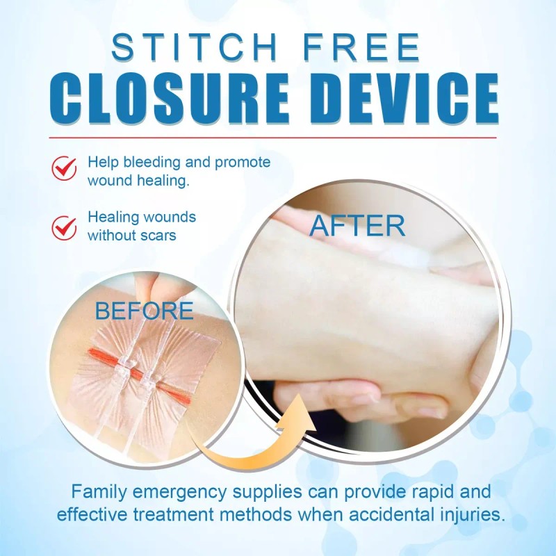Tiras de Cierre de Heridas de Emergencia Marca Jzuczv 2