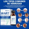 Sistema De Verruga Elimina Plantar Y Comunes 30ml