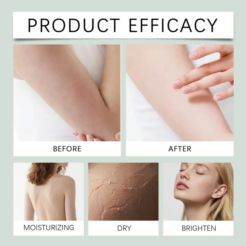 Crema Para Intertrigo Y Pliegues Cutáneos 57 G Neutra