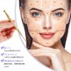 2 Point Trigger Point Pusher, Face Beautifying, Pen Type, Myofascial