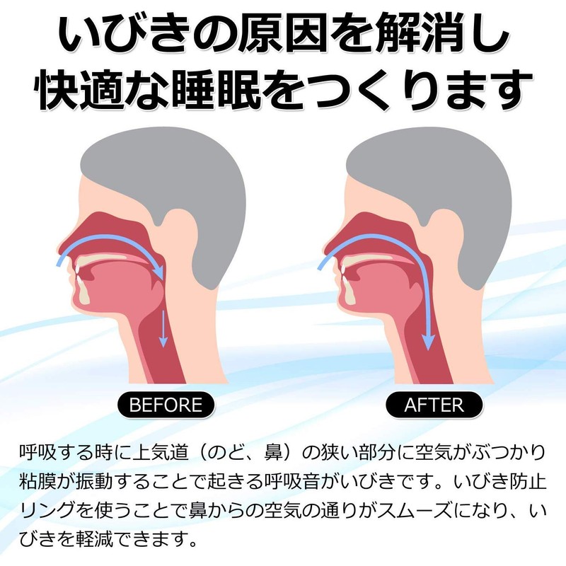 ［Utiel］いびき 防止 リング 改善 軽減 対策 睡眠 安眠 グッズ 指輪