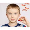 Fruidles Gummi Teeth Candy, Delicious Fruit Flavors Gummies (17.6 Pounds)