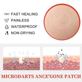 2PCS Microdarts Patch-Acne Pimple Skin Removal Patches - Botanic Formula with Tea Tree & Centella, Fast Absorb Micro Needle Patches for All Skin Types,Multi-purpose stickers