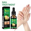Nail Treatment, Ginger Nail Treatment Toenails Repair, Ginger Fingernails Care