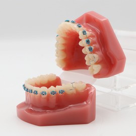 1 Pair of Temporary Tooth Decoration, Teeth Retainer Practical Brackets para Dientes Sturdy Retenedores de Dientes Ortodoncia Props for Dental Students to Practice (Blue)