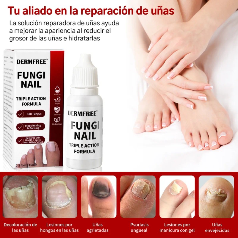 Fungicida Para Uñas Con Hongos, Amarillas,engrosadas Y Duras