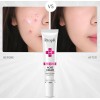 RtopR 3 Cream For Fading Acne Scars Smooth Clear Dark