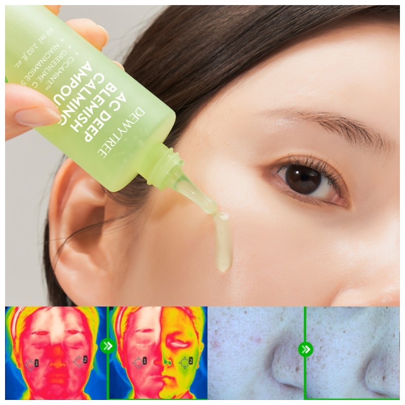 DEWYTREE AC Deep Blemish Calming Special Gift Set 5items [SUMMER