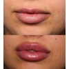 Lip Plumping Lip Gloss - Makeup Cosmetic Hydrating Moisturizing Glossy