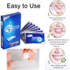 iZhuoKe 28 Pieces Teeth Whitening Strips,Teeth Whitening,Professional Teeth Stain Removal,Whiten