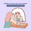 Acne Cover Spot Patch for Olive Young Care Plus Spot